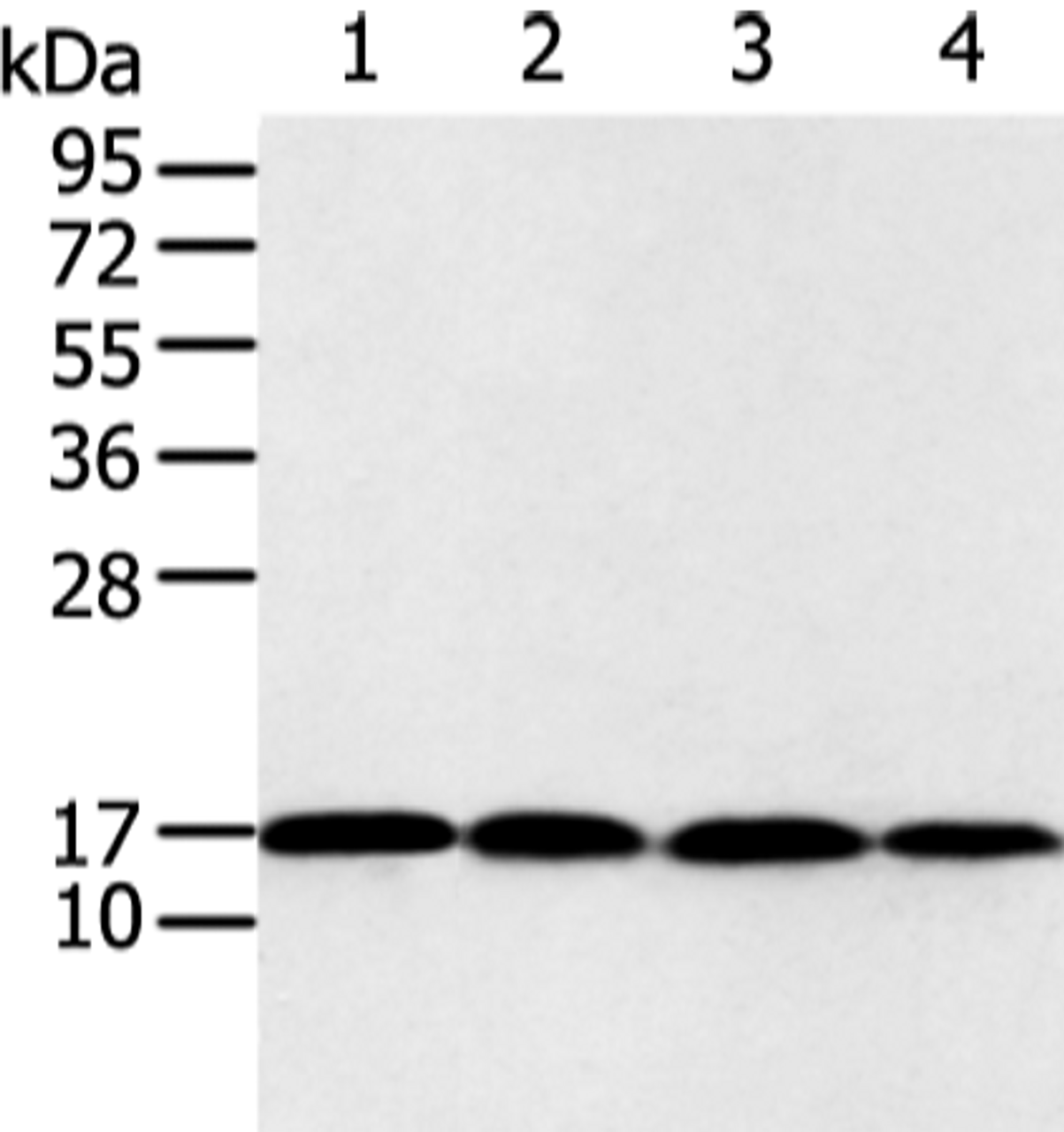 Western blot analysis of 293T and Jurkat cell  using UBE2I Polyclonal Antibody at dilution of 1:650