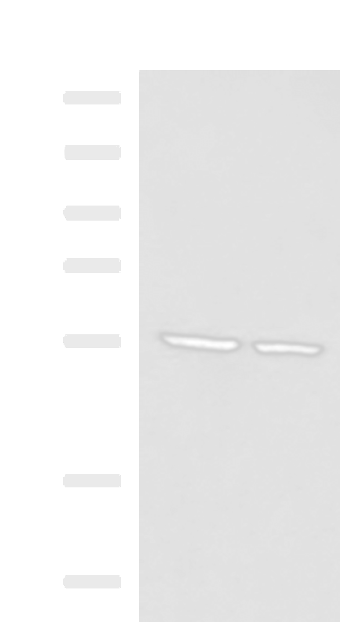 Western blot analysis of LOVO and LO2 cell lysates  using ECM1 Polyclonal Antibody at dilution of 1:650