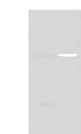 Western blot analysis of Human left kidney tissue and Human fetal liver tissue lysates  using DDC Polyclonal Antibody at dilution of 1:400