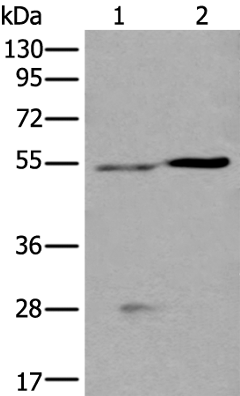 Western blot analysis of Human left kidney tissue and Human fetal liver tissue lysates  using DDC Polyclonal Antibody at dilution of 1:400