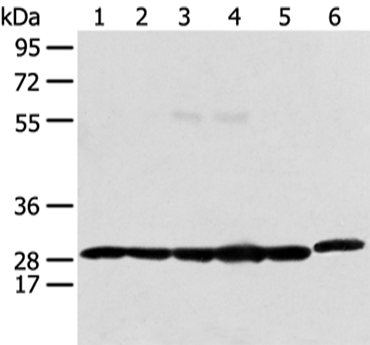 Western blot analysis of 293T Raji and Hela cell  using PRDX4 Polyclonal Antibody at dilution of 1:400