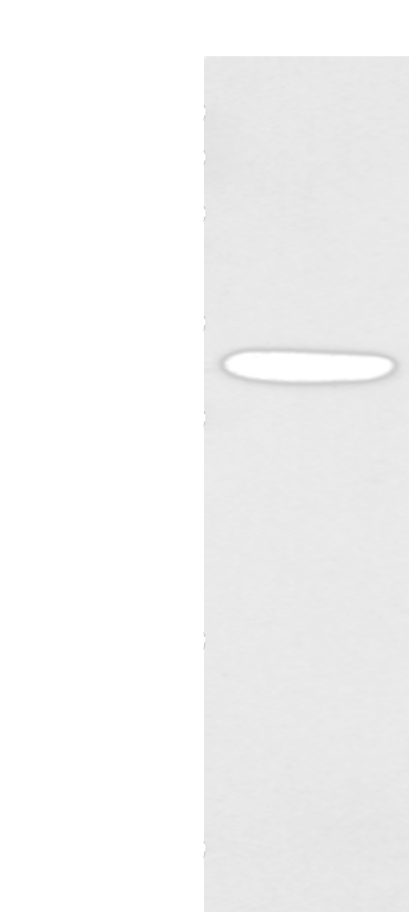 Western blot analysis of Mouse muscle tissue  using NANOS1 Polyclonal Antibody at dilution of 1:400