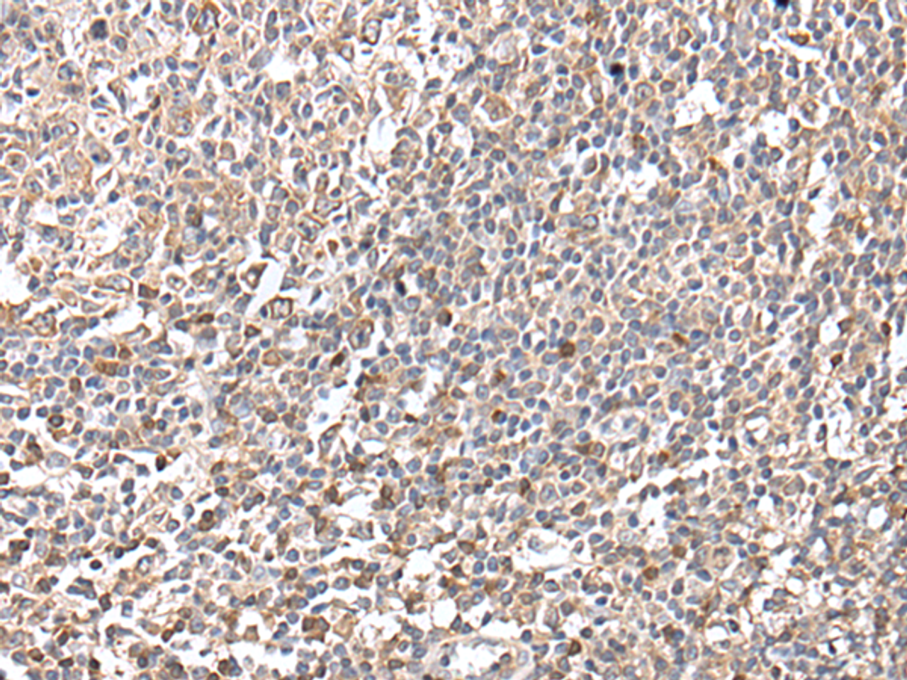 Immunohistochemistry of paraffin-embedded Human tonsil tissue  using GNAI2 Polyclonal Antibody at dilution of 1:25(×200)