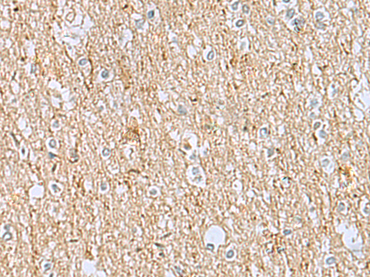 Immunohistochemistry of paraffin-embedded Human brain tissue  using LRRC49 Polyclonal Antibody at dilution of 1:40(×200)