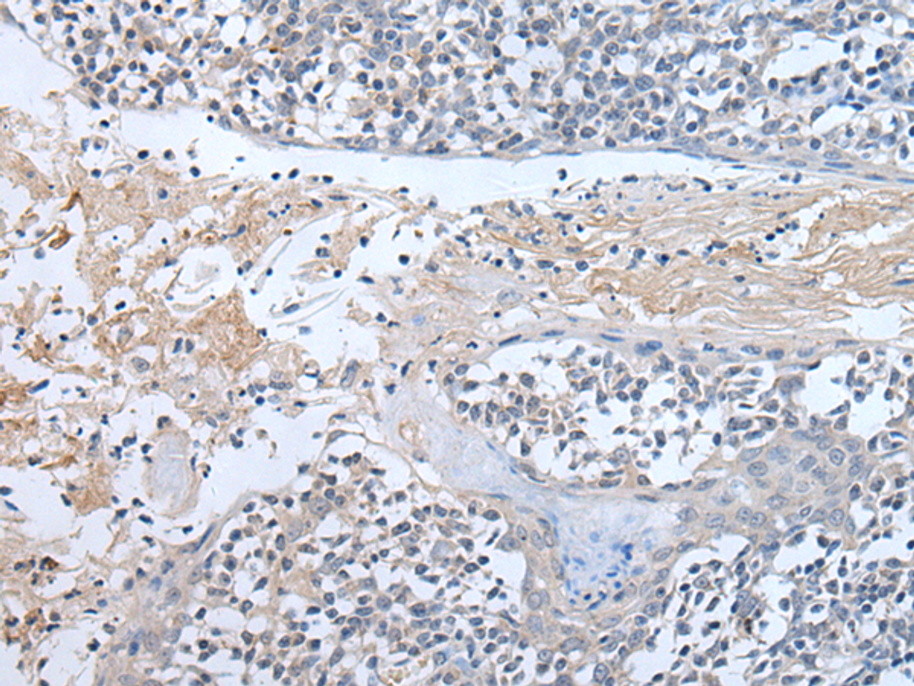 Immunohistochemistry of paraffin-embedded Human tonsil tissue  using ABR Polyclonal Antibody at dilution of 1:50(×200)