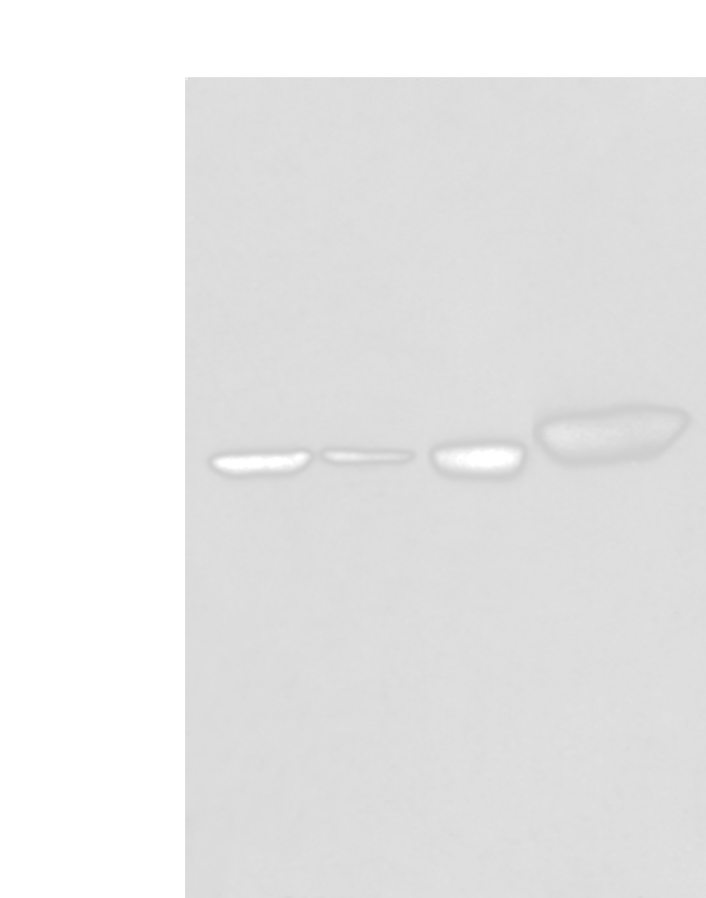 Western blot analysis of Hepg2 A431 Hela and A549 cell lysates  using PLAG1 Polyclonal Antibody at dilution of 1:250