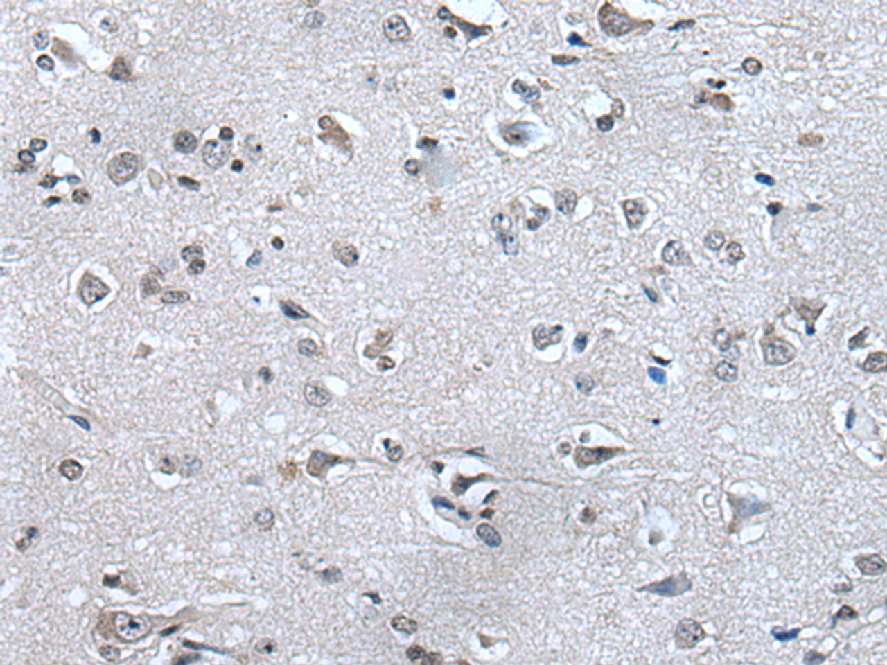 Immunohistochemistry of paraffin-embedded Human brain tissue  using HAND1 Polyclonal Antibody at dilution of 1:30(×200)
