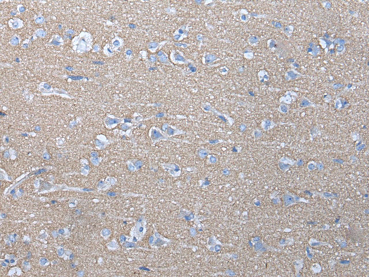 Immunohistochemistry of paraffin-embedded Human brain tissue  using ETFB Polyclonal Antibody at dilution of 1:40(×200)