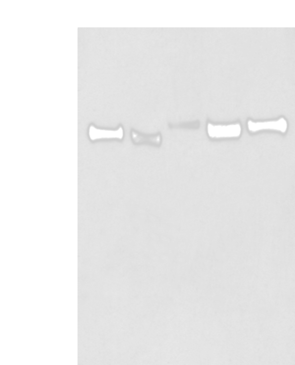 Western blot analysis of Human cerebella tissue Human cerebrum tissue Human fetal brain tissue Mouse brain tissue Rat brain tissue lysates  using CNTN1 Polyclonal Antibody at dilution of 1:350