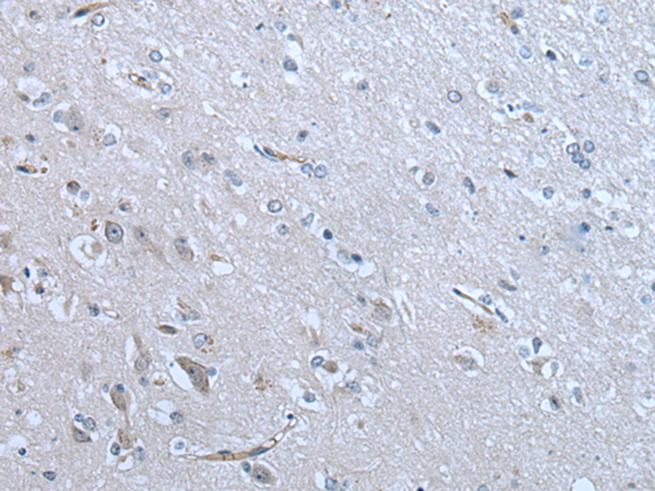 Immunohistochemistry of paraffin-embedded Human brain tissue  using ZC3HAV1 Polyclonal Antibody at dilution of 1:70(×200)