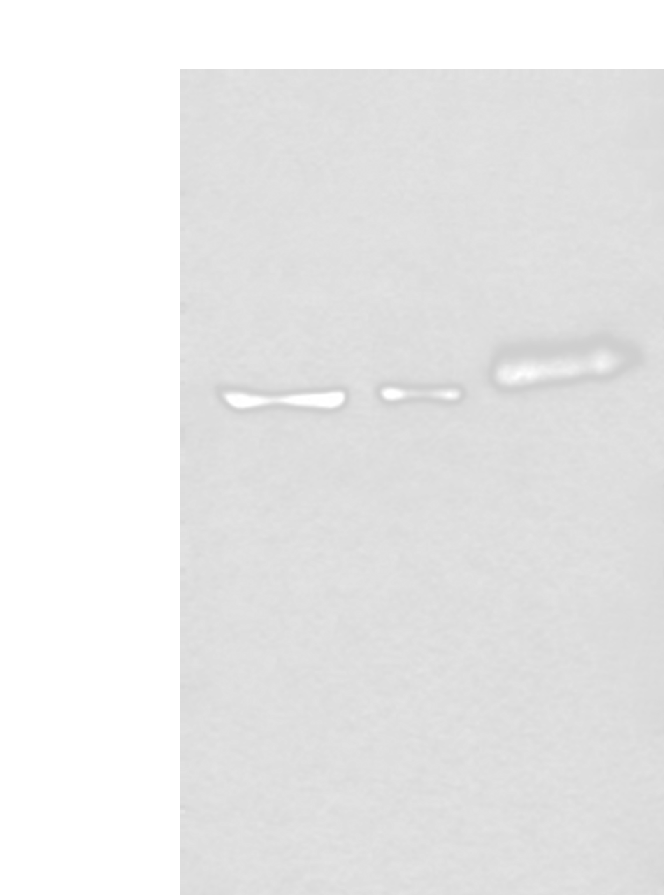 Western blot analysis of Hela cell Mouse kidney tissue and Human colorectal cancer tissue lysates  using YY2 Polyclonal Antibody at dilution of 1:800