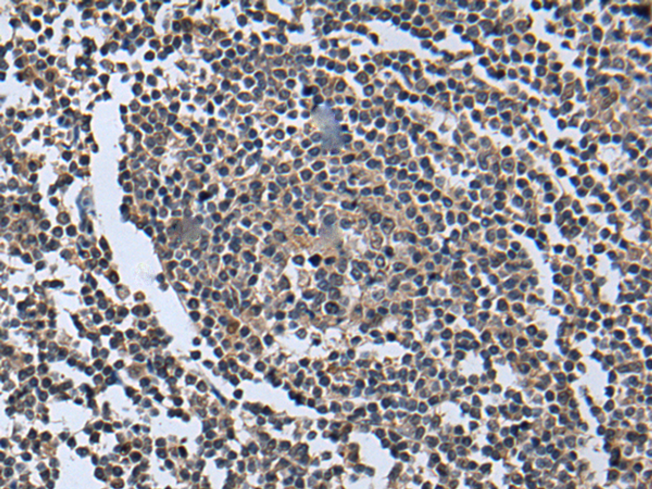 Immunohistochemistry of paraffin-embedded Human tonsil tissue  using WNT9B Polyclonal Antibody at dilution of 1:85(×200)