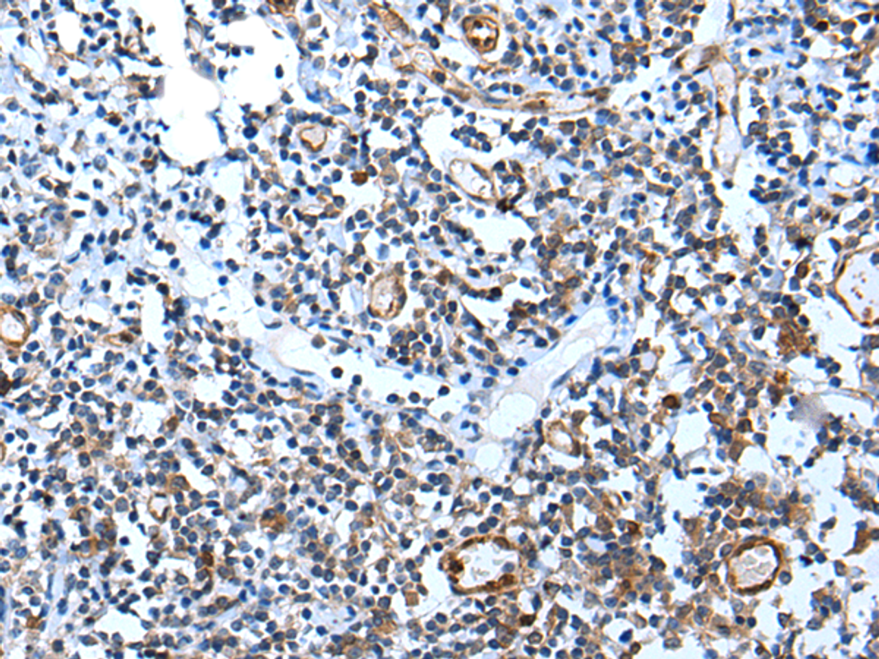 Immunohistochemistry of paraffin-embedded Human tonsil tissue  using USP37 Polyclonal Antibody at dilution of 1:45(×200)