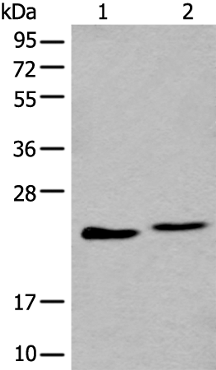 Western blot analysis of A549 and K562 cell lysate  using BLVRB Polyclonal Antibody at dilution of 1:600