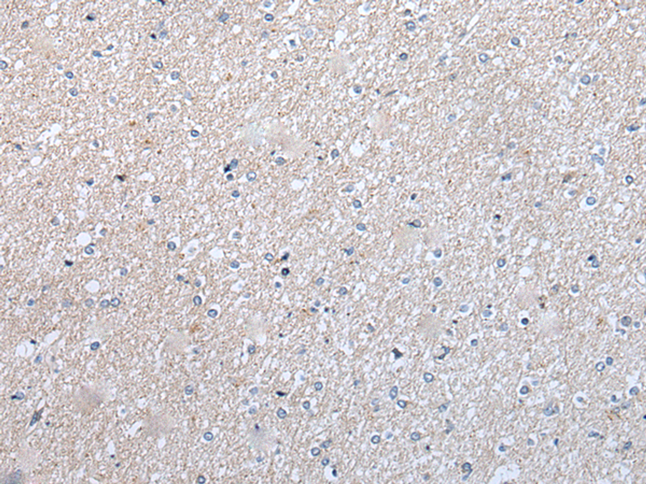 Immunohistochemistry of paraffin-embedded Human brain tissue  using ENPP2 Polyclonal Antibody at dilution of 1:50(×200)