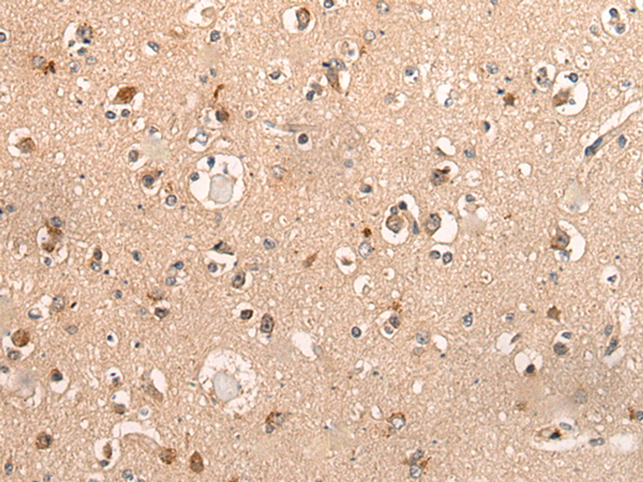 Immunohistochemistry of paraffin-embedded Human brain tissue  using DYNAP Polyclonal Antibody at dilution of 1:50(×200)
