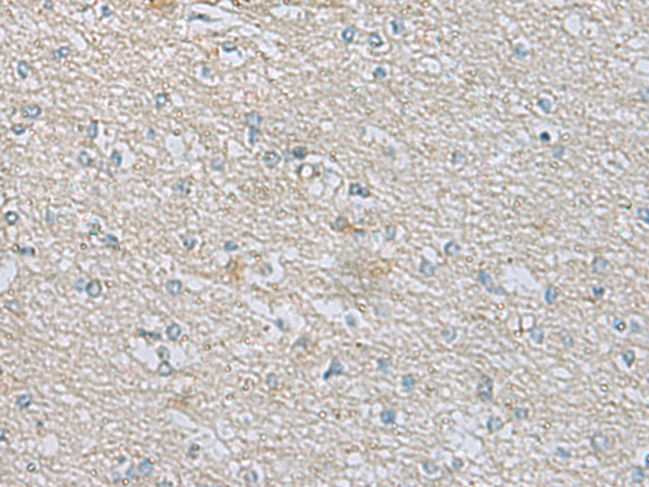 Immunohistochemistry of paraffin-embedded Human brain tissue  using CDH12 Polyclonal Antibody at dilution of 1:60(×200)