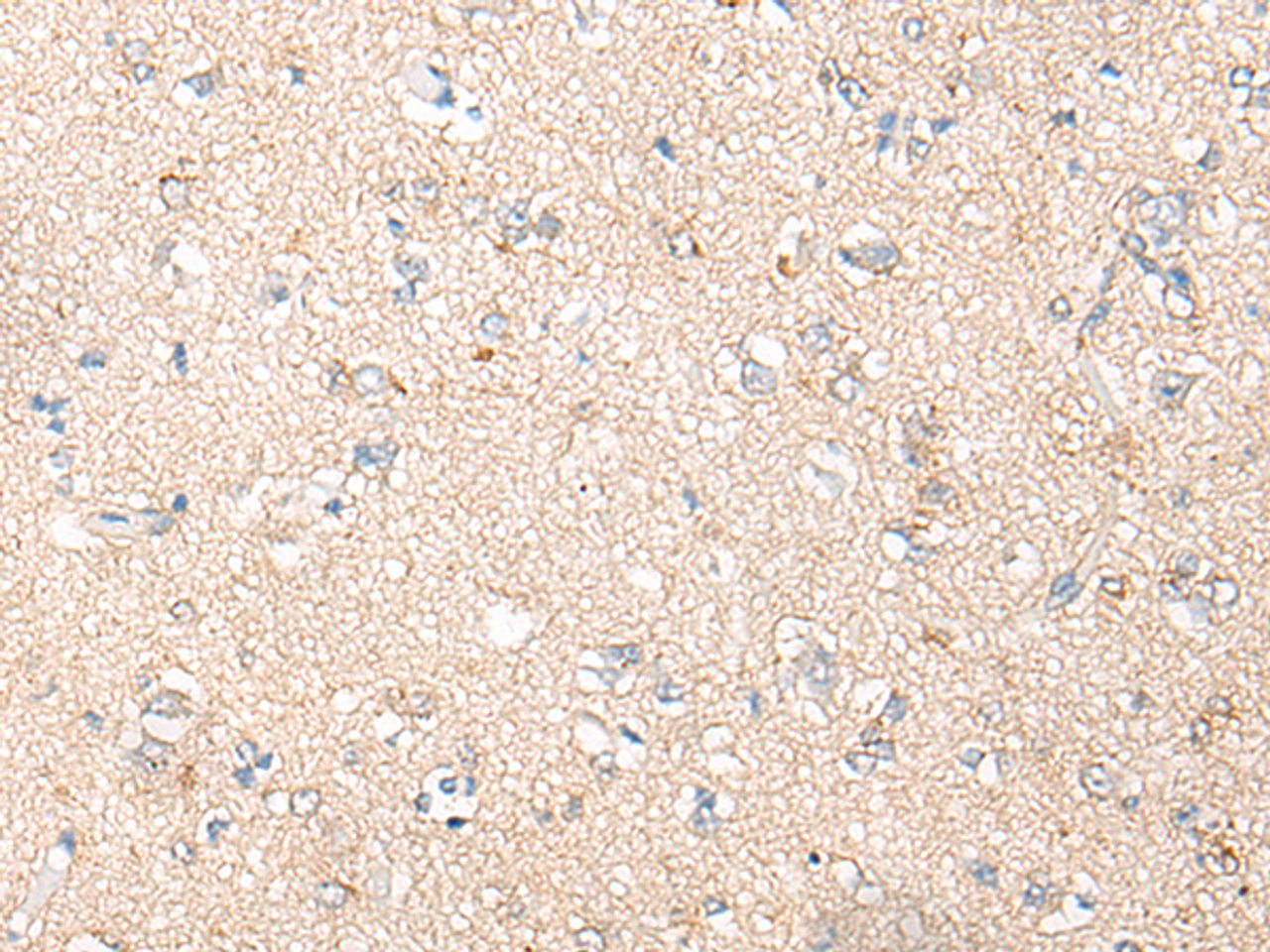 Immunohistochemistry of paraffin-embedded Human brain tissue  using PNPO Polyclonal Antibody at dilution of 1:30(×200)