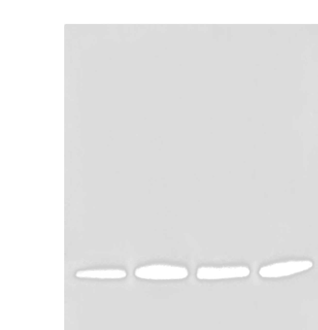 Western blot analysis of Human prostate tissue PC-3 A549 and TM4 cell lysates  using HIST1H2BA Polyclonal Antibody at dilution of 1:500