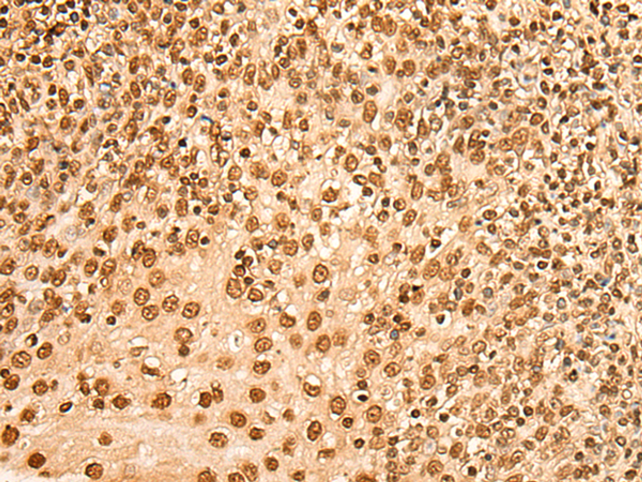 Immunohistochemistry of paraffin-embedded Human tonsil tissue  using HIST1H2BA Polyclonal Antibody at dilution of 1:45(×200)
