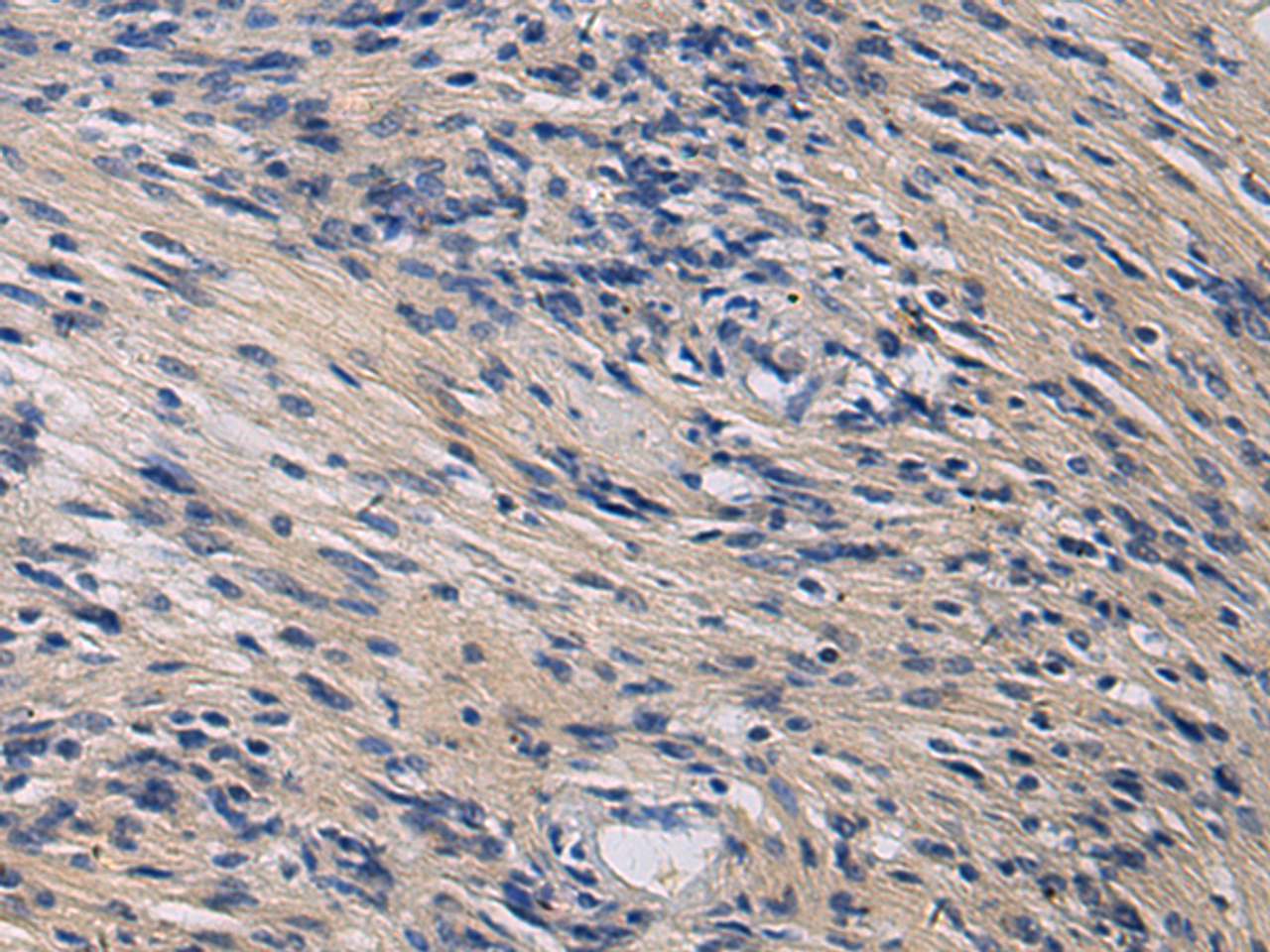 Immunohistochemistry of paraffin-embedded Human brain tissue  using KLF1 Polyclonal Antibody at dilution of 1:35(×200)