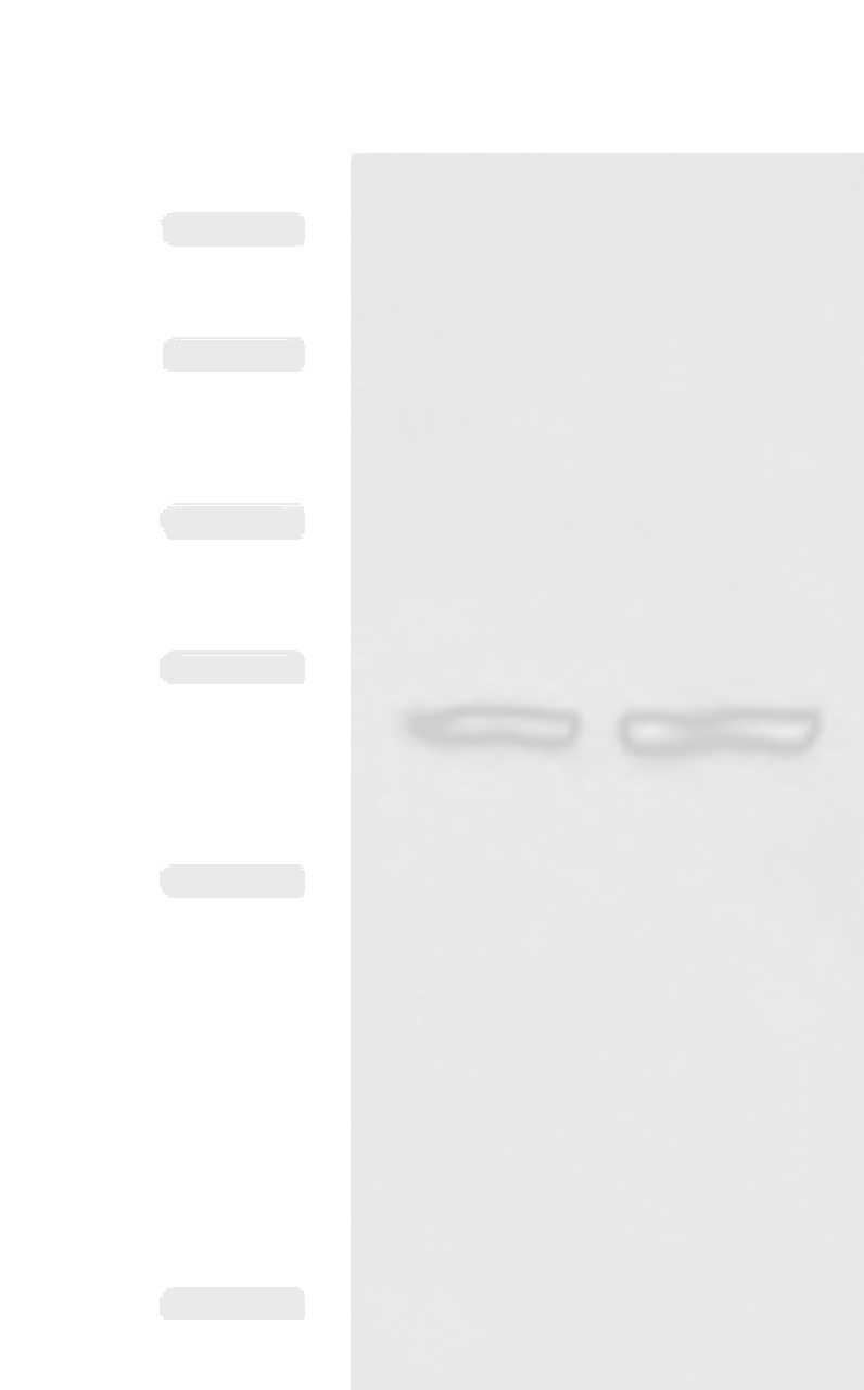 Western blot analysis of Human cerebella tissue Human cerebrum tissue lysates  using FNBP1L Polyclonal Antibody at dilution of 1:750