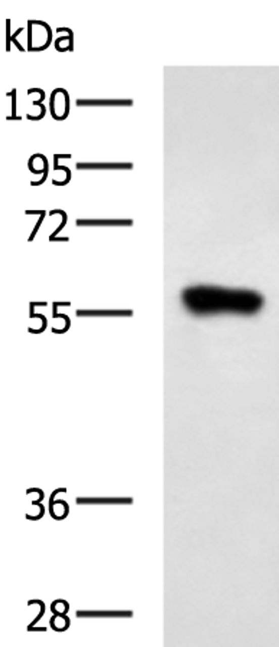 Western blot analysis of Raji cell lysate  using SQSTM1 Polyclonal Antibody at dilution of 1:900