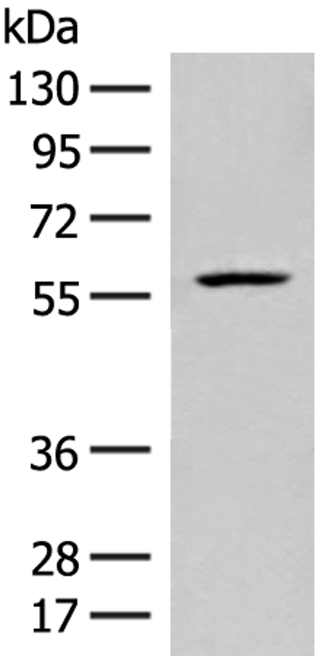 Western blot analysis of Mouse liver tissue lysate  using FKTN Polyclonal Antibody at dilution of 1:450