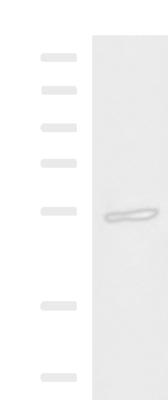 Western blot analysis of 231 cell lysate  using GBA Polyclonal Antibody at dilution of 1:1350