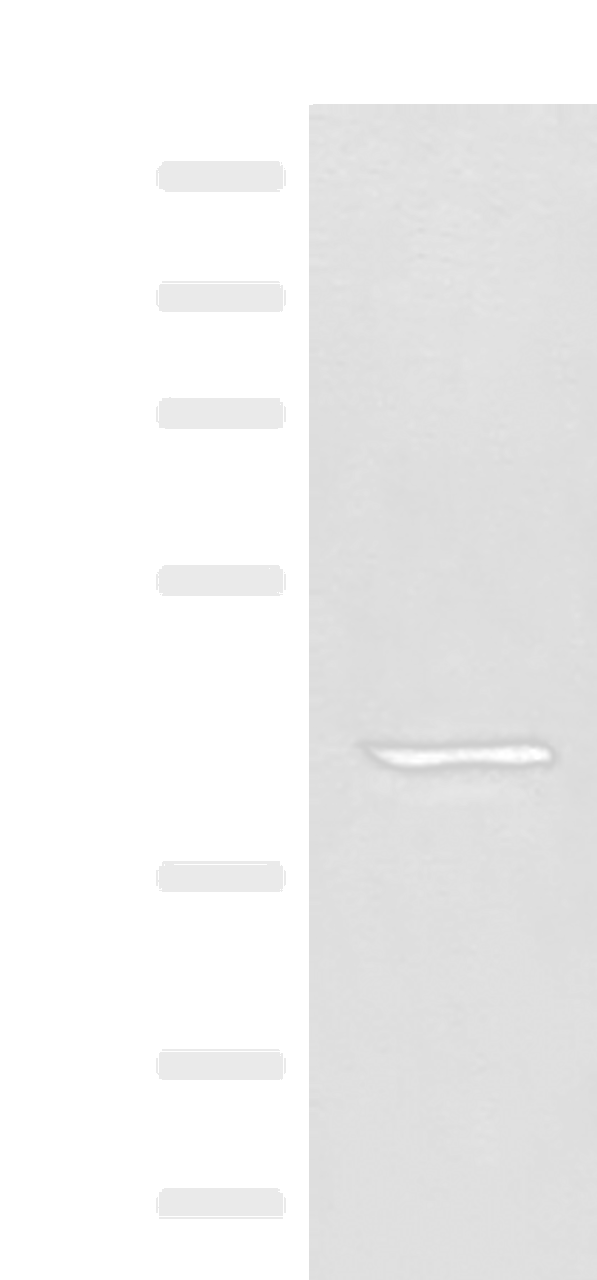 Western blot analysis of A549 cell lysate  using GPR62 Polyclonal Antibody at dilution of 1:350
