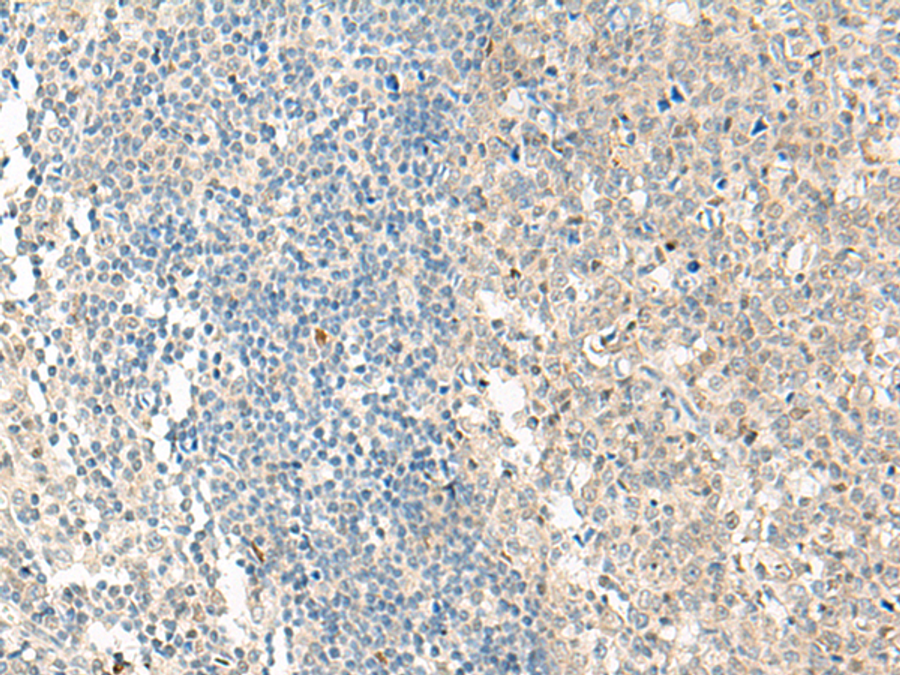 Immunohistochemistry of paraffin-embedded Human tonsil tissue  using NPBWR1 Polyclonal Antibody at dilution of 1:50(×200)