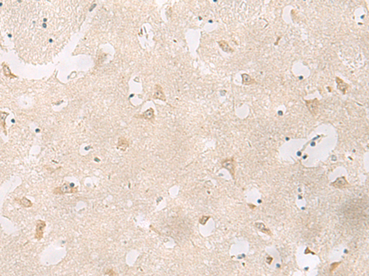 Immunohistochemistry of paraffin-embedded Human brain tissue  using GPR83 Polyclonal Antibody at dilution of 1:60(×200)