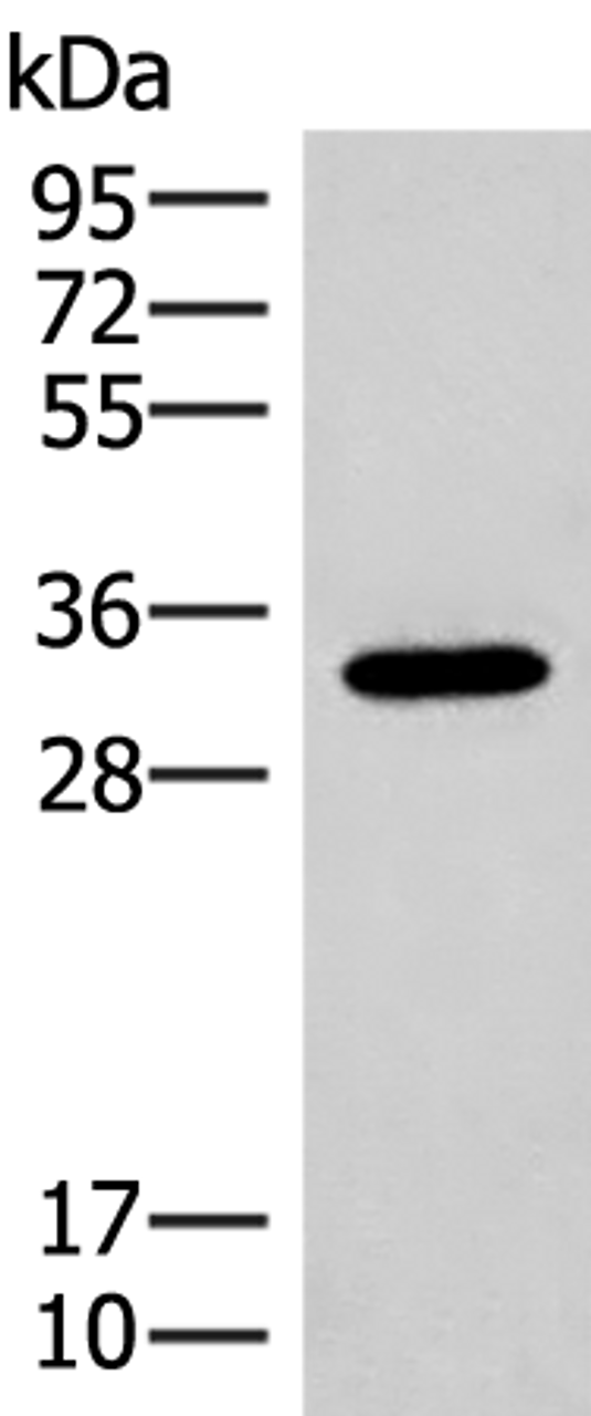 Western blot analysis of Mouse liver tissue lysate  using RGR Polyclonal Antibody at dilution of 1:300