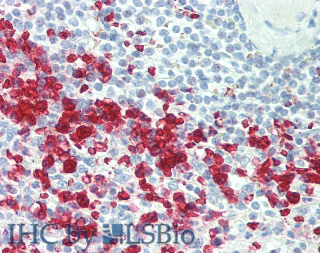 Immunohistochemistry of paraffin-embedded Spleen tissue using CCL17 Polyclonal Antibody at dilution of 1:100 (Elabscience® Product Detected by Lifespan).