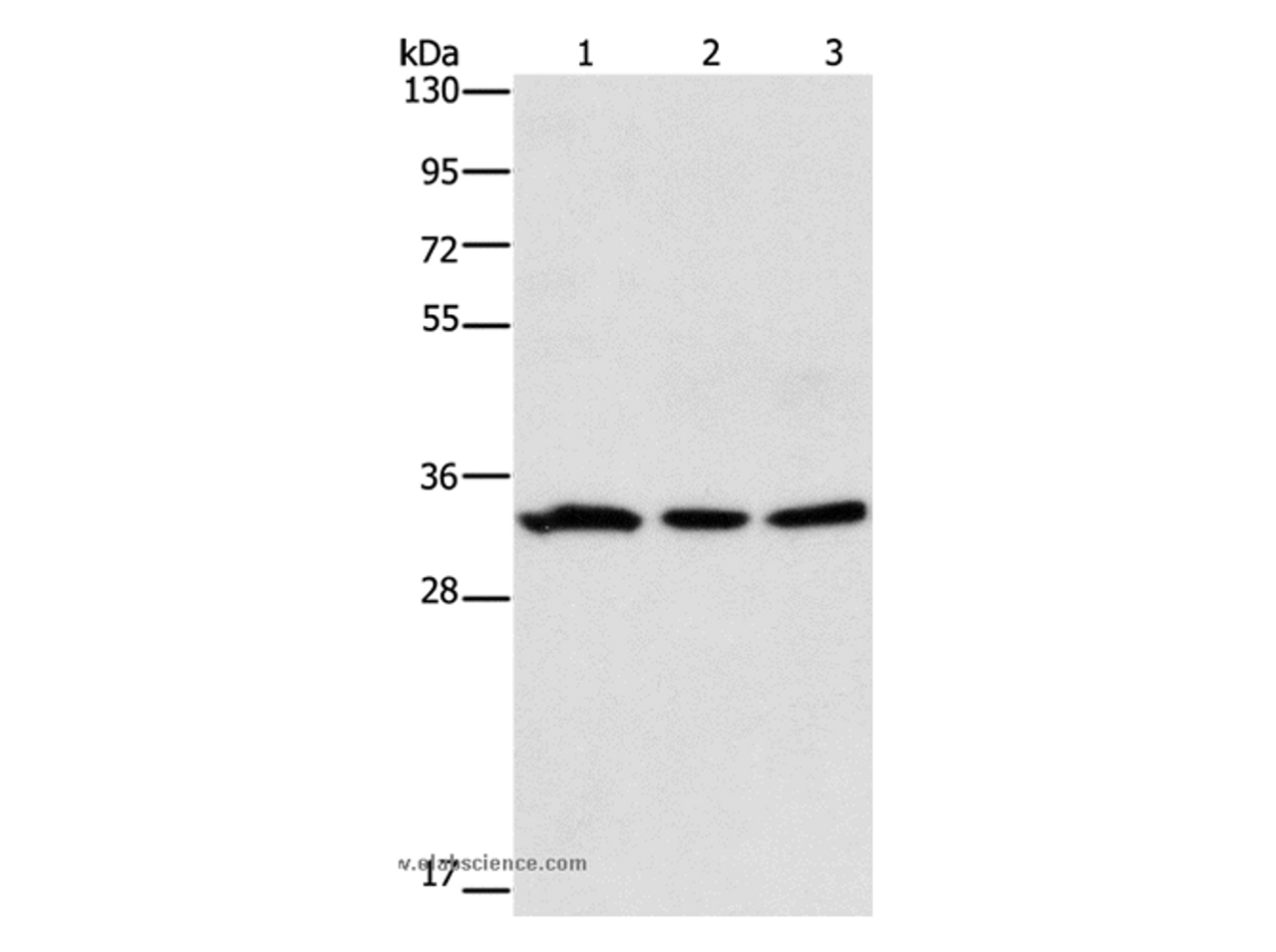 Western Blot analysis of 293T and Human colon cancer tissue, 231 cell using GPA33 Polyclonal Antibody at dilution of 1:600