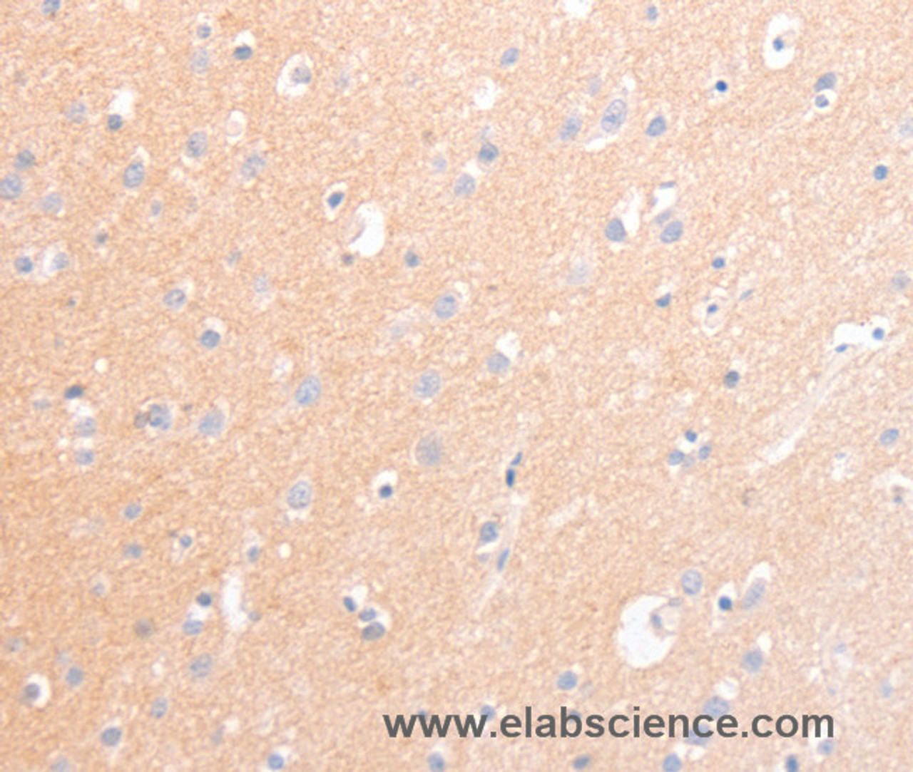 Immunohistochemistry of paraffin-embedded Human brain tissue using CD56 Polyclonal Antibody at dilution 1:30