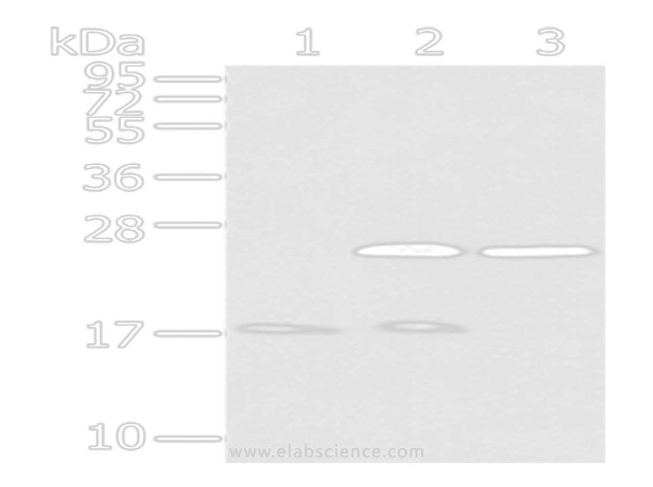 Western Blot analysis of Human fetal brain tissue, Hela and 293T cells using PDPN Polyclonal Antibody at dilution of 1/200