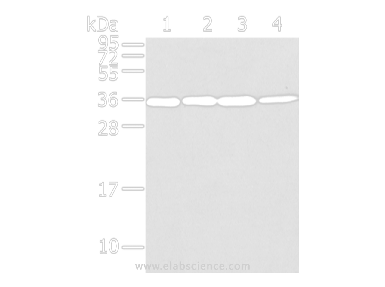Western Blot analysis of Lovo, 293T, Jurkat and hela cell using CBX7 Polyclonal Antibody at dilution of 1/200