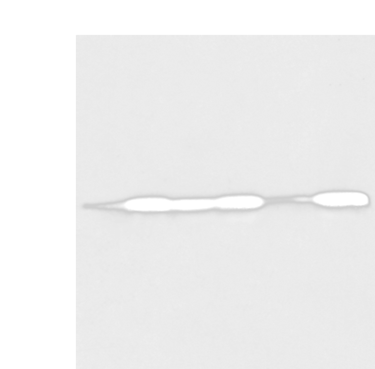 Western blot analysis of Human fetal muscle tissue HEPG2 Jurkat Hela A431 and A549 cell  using BAG2 Polyclonal Antibody at dilution of 1:550