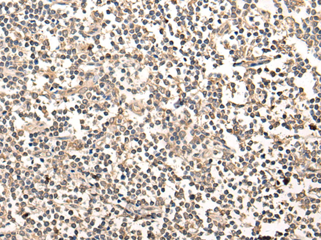 Immunohistochemistry of paraffin-embedded Human tonsil tissue  using MAGEA1 Polyclonal Antibody at dilution of 1:65(×200)