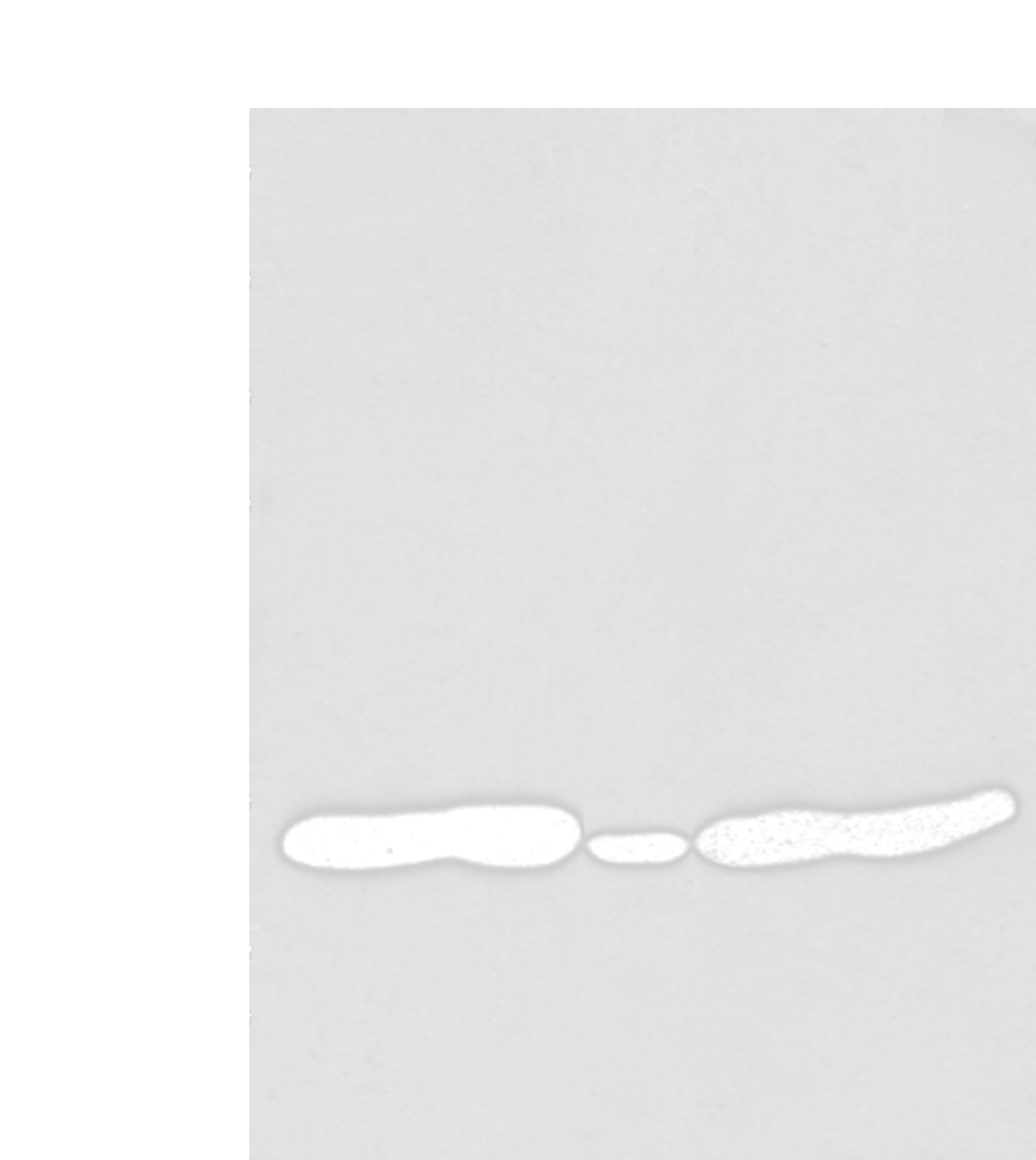 Western blot analysis of 231 Mouse heart tissue Human fetal brain tissue Jurkat and Hepg2 cell  using HOXC11 Polyclonal Antibody at dilution of 1:250