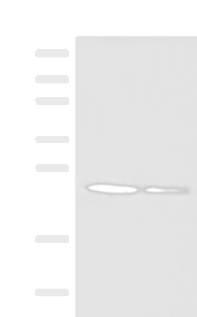 Western blot analysis of 293T and A549 cell lysates  using CD63 Polyclonal Antibody at dilution of 1:800