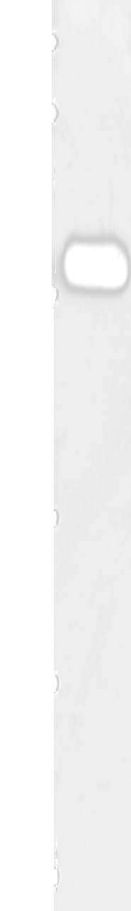 Western blot analysis of Human notum skin cancer tissue  using DOK3 Polyclonal Antibody at dilution of 1:500