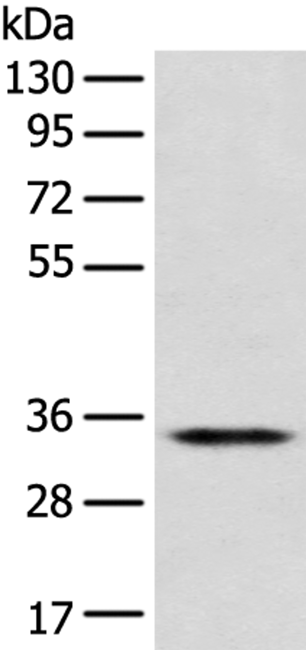 Western blot analysis of Jurkat cell  using CD1D Polyclonal Antibody at dilution of 1:300