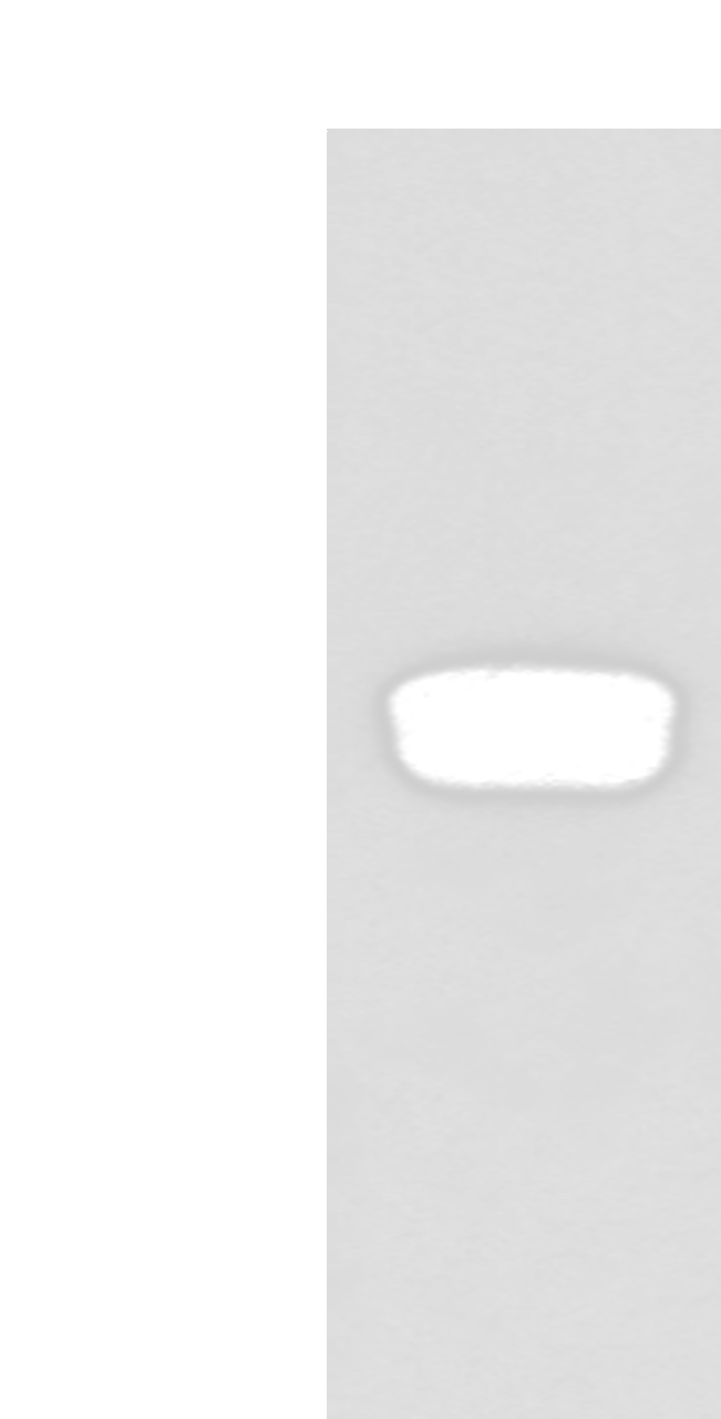 Western blot analysis of Human testis tissue  using GLIPR1L1 Polyclonal Antibody at dilution of 1:300