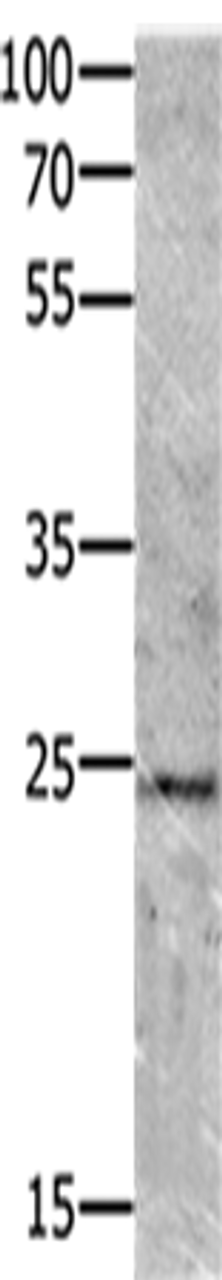 Western blot analysis of Mouse brain tissue  using VEGFB Polyclonal Antibody at dilution of 1:700