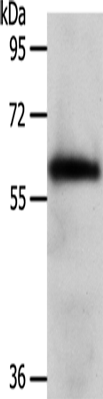 Western blot analysis of Mouse brain tissue  using WDR1  Polyclonal Antibody at dilution of 1:1000