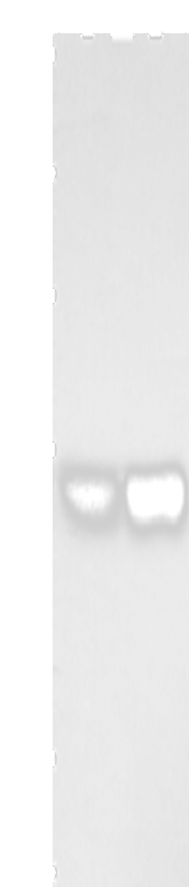 Western blot analysis of Hela cells A431 cells  using ZFYVE19  Polyclonal Antibody at dilution of 1:500