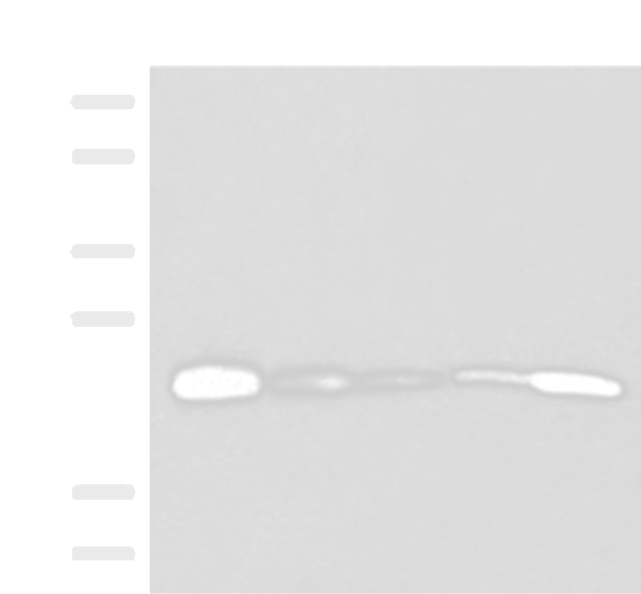 Western blot analysis of 293T 231 HUVEC Hela and A549 cell lysates  using MT-CO2 Polyclonal Antibody at dilution of 1:400