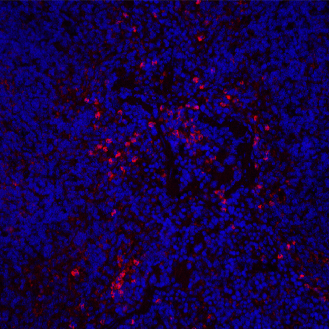 Immunofluorescence analysis of Mouse inflammatory spleen  using ITGAX Polyclonal Antibody at dilution of 1:200.